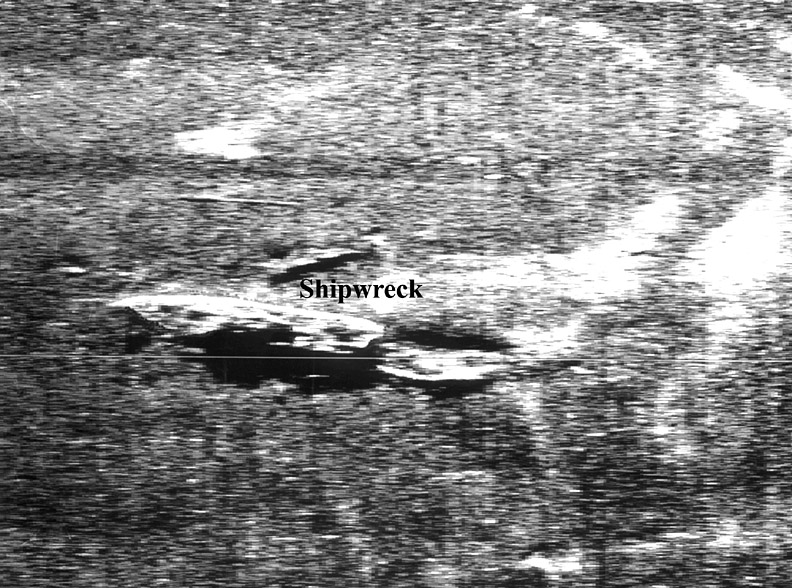 sidescan sonar record of an area of The Narrows showing a recently discovered shipwreck